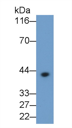 Monoclonal Antibody to Interleukin 1 Beta (IL1b)