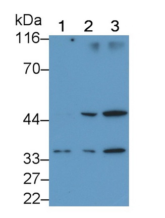 Monoclonal Antibody to Interleukin 1 Beta (IL1b)