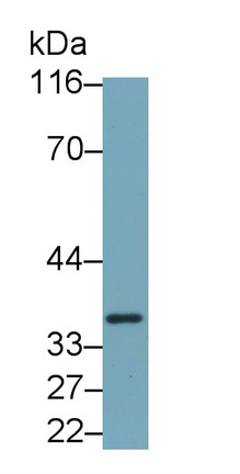 Monoclonal Antibody to Interleukin 1 Beta (IL1b)