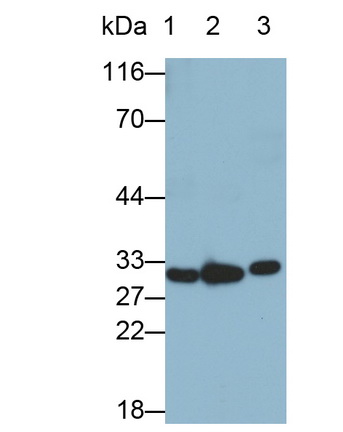 Monoclonal Antibody to Interleukin 1 Beta (IL1b)