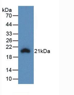 Monoclonal Antibody to Interleukin 1 Beta (IL1b)