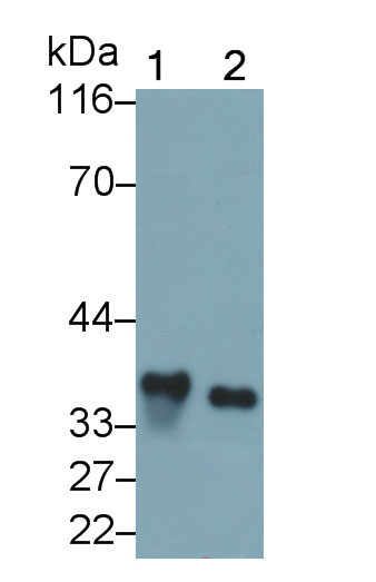 Monoclonal Antibody to Interleukin 1 Beta (IL1b)