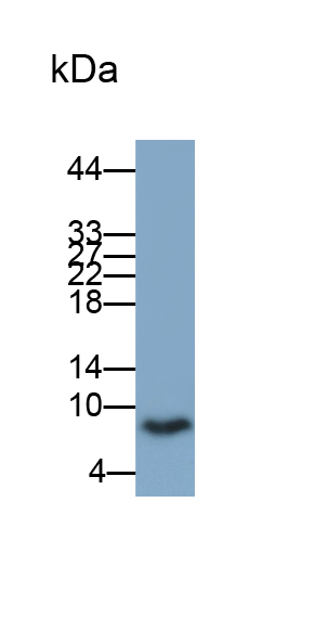 Monoclonal Antibody to S100 Calcium Binding Protein B (S100B)