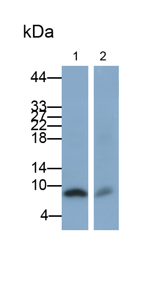 Monoclonal Antibody to S100 Calcium Binding Protein B (S100B)