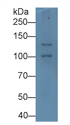 Monoclonal Antibody to Procollagen III N-Terminal Propeptide (PIIINP)