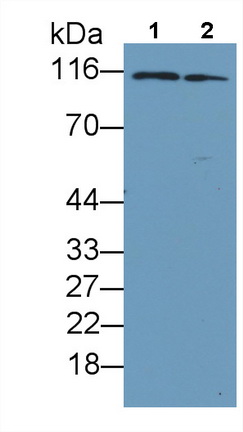 Monoclonal Antibody to Procollagen III N-Terminal Propeptide (PIIINP)