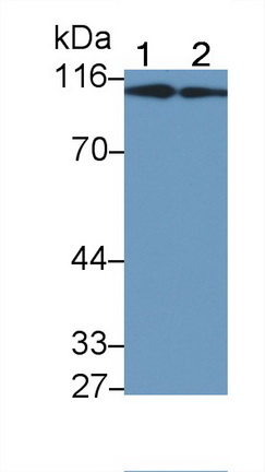 Monoclonal Antibody to Procollagen III N-Terminal Propeptide (PIIINP)