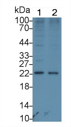 Monoclonal Antibody to Procollagen III N-Terminal Propeptide (PIIINP)