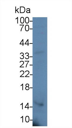 Monoclonal Antibody to Procollagen III N-Terminal Propeptide (PIIINP)