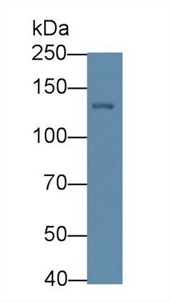 Monoclonal Antibody to Procollagen III N-Terminal Propeptide (PIIINP)