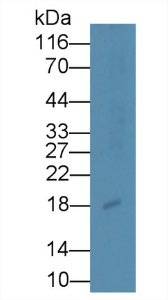 Monoclonal Antibody to Procollagen III N-Terminal Propeptide (PIIINP)