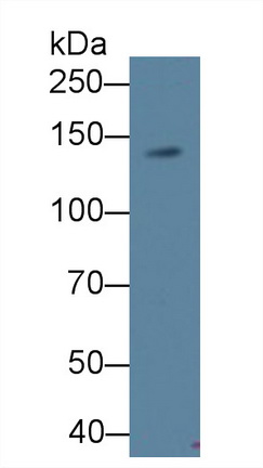 Monoclonal Antibody to Procollagen III N-Terminal Propeptide (PIIINP)