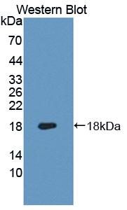 Monoclonal Antibody to Heme Oxygenase 1 (HO1)