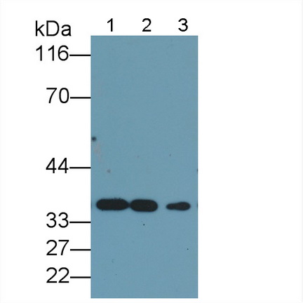 Monoclonal Antibody to Proliferating Cell Nuclear Antigen (PCNA)