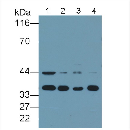 Monoclonal Antibody to Proliferating Cell Nuclear Antigen (PCNA)