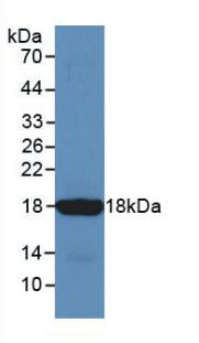 Monoclonal Antibody to Somatostatin (SST)