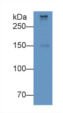 Monoclonal Antibody to Apolipoprotein <b>B100</b> (APO<b>B100</b>)