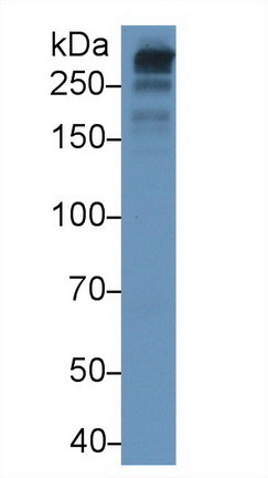 Monoclonal Antibody to Apolipoprotein <b>B100</b> (APO<b>B100</b>)