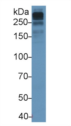 Monoclonal Antibody to Apolipoprotein B100 (APOB100)