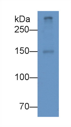 Monoclonal Antibody to Apolipoprotein B100 (APOB100)