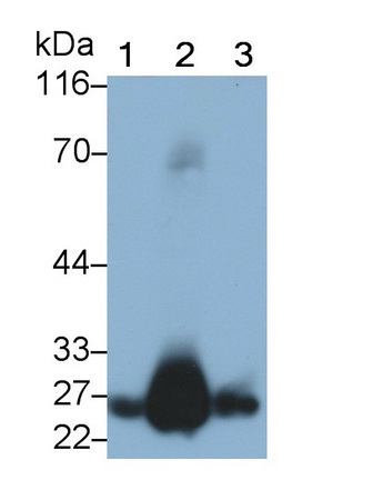 Monoclonal Antibody to Glutathione S Transferase Alpha 1 (GSTa1)