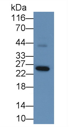 Monoclonal Antibody to Glutathione S Transferase Alpha 1 (GSTa1)