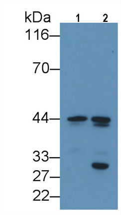 Monoclonal Antibody to CCAAT/Enhancer Binding Protein Alpha (CEBPa)