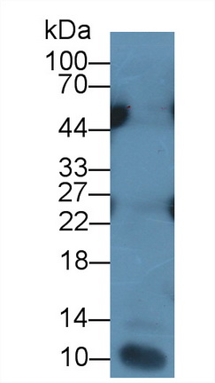 Monoclonal Antibody to Interleukin 7 (IL7)