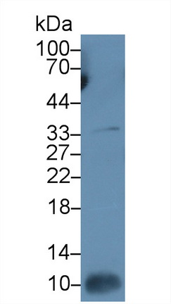 Monoclonal Antibody to Interleukin 7 (IL7)