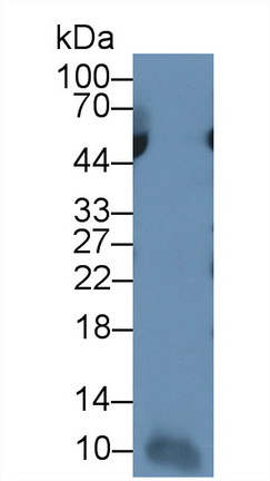 Monoclonal Antibody to Interleukin 7 (IL7)