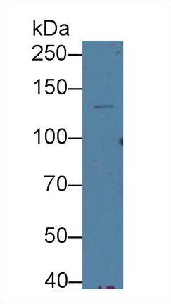 Monoclonal Antibody to Cross Linked C-Telopeptide Of Type I Collagen (CTXI)