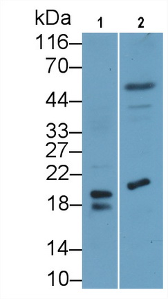 Monoclonal Antibody to Procalcitonin (PCT)