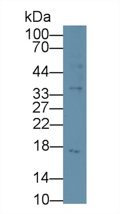 Monoclonal Antibody to Procalcitonin (PCT)