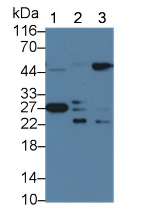 Monoclonal Antibody to Heat Shock Protein 27 (Hsp27)