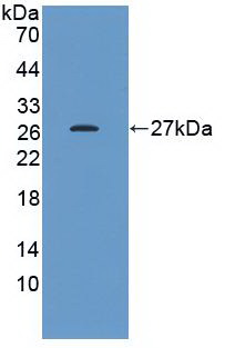 Monoclonal Antibody to Heat Shock Protein 27 (Hsp27)