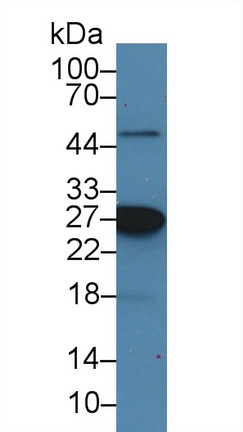 Monoclonal Antibody to Heat Shock Protein 27 (Hsp27)