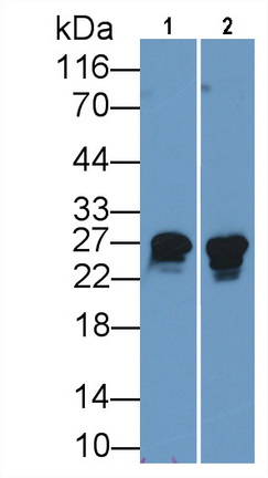 Monoclonal Antibody to Heat Shock Protein 27 (Hsp27)