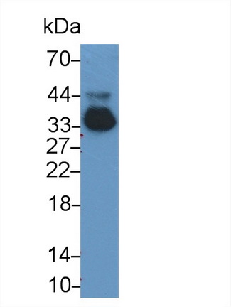 Monoclonal Antibody to Apolipoprotein E (APOE)