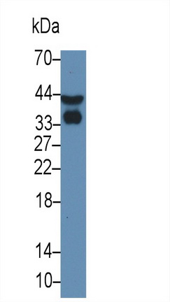 Monoclonal Antibody to Apolipoprotein E (APOE)