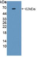 Monoclonal Antibody to Prothrombin Fragment 1+2 (F1+2)