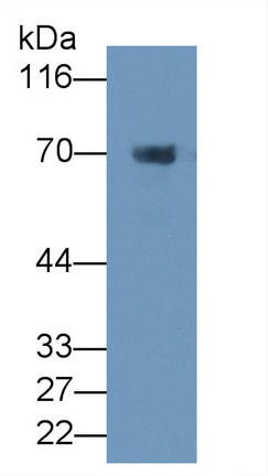 Monoclonal Antibody to Prothrombin Fragment 1+2 (F1+2)