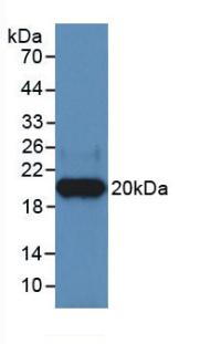 Monoclonal Antibody to Heparanase (HPSE)