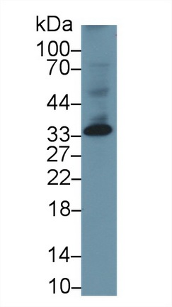 Monoclonal Antibody to Dickkopf Related Protein 1 (DKK1)