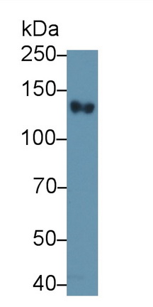 Monoclonal Antibody to Complement Receptor 2 (CD21)