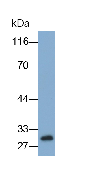 Monoclonal Antibody to Programmed Cell Death Protein 1 (PD1)