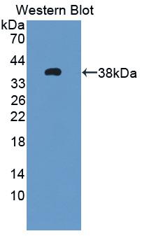 Monoclonal Antibody to Toll Like Receptor 4 (TLR4)