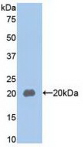 Monoclonal Antibody to Mucin 5 Subtype AC (MUC5AC)