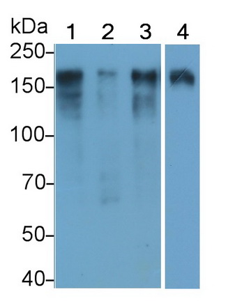 Monoclonal Antibody to Epidermal Growth Factor Receptor (EGFR)