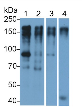 Monoclonal Antibody to Epidermal Growth Factor Receptor (EGFR)