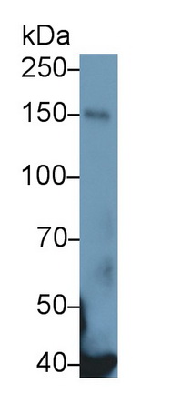 Monoclonal Antibody to Epidermal Growth Factor Receptor (EGFR)